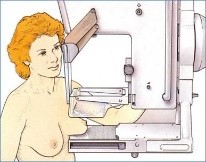 En la Mujer, realizarse la Mastografía por lo menos una vez al año.
