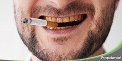 Surgen otros problemas como la halitosis y problemas en los dientes.