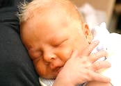 Otro bebé con Ictericia del Recién Nacido