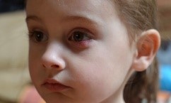 El niño que se talle frecuentemente los ojos es posible que se provoque un orzuelo.