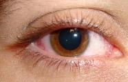 Una gran dilatación de la pupila, signo inequívoco de que la persona está drogado.