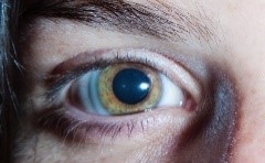 Una pupila dilatada es signo inequívoco de que estás drogado.